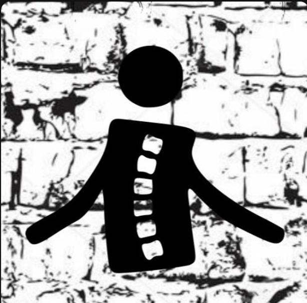 Deformitet